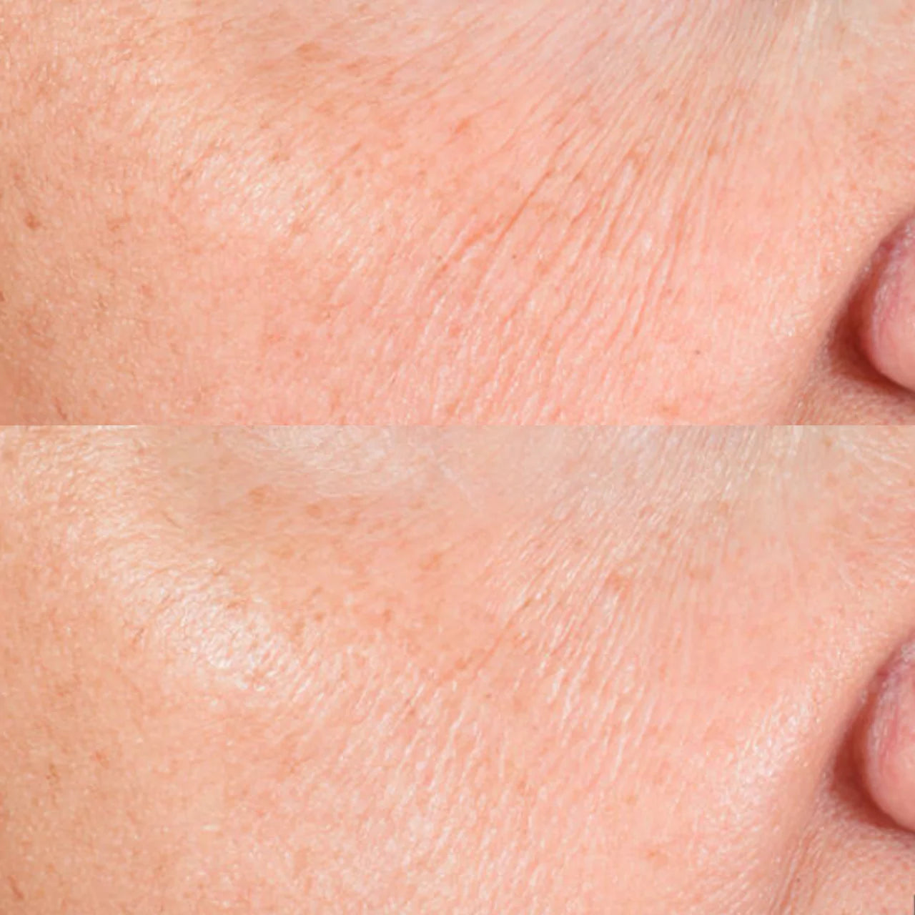SkinCeuticals A.G.E. Advanced Eye reduces dark circles, brightening and revitalizing tired-looking eyes.
