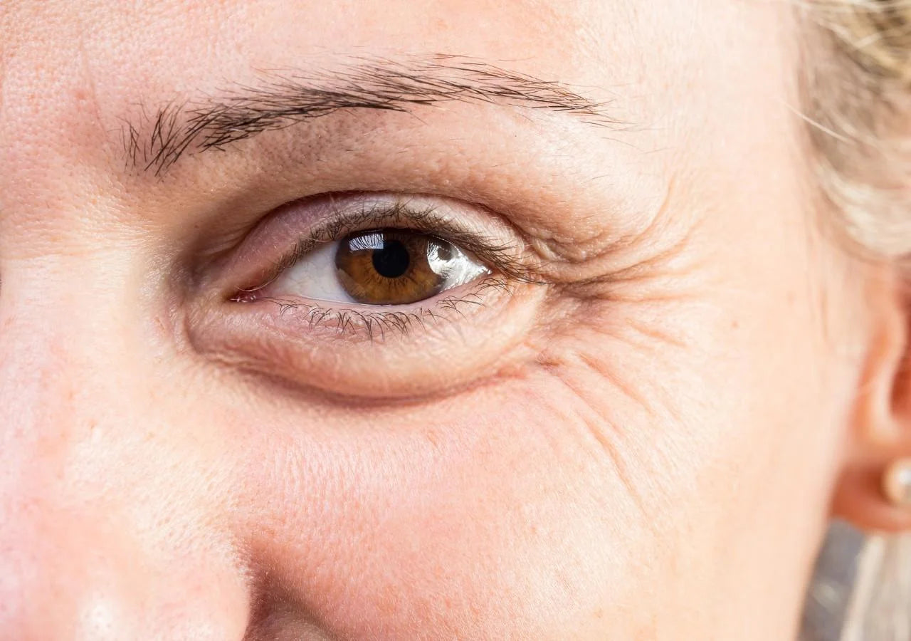 Firming eye cream with Matrixyl™ & Eyeliss™ peptides to tighten skin and smooth fine lines.