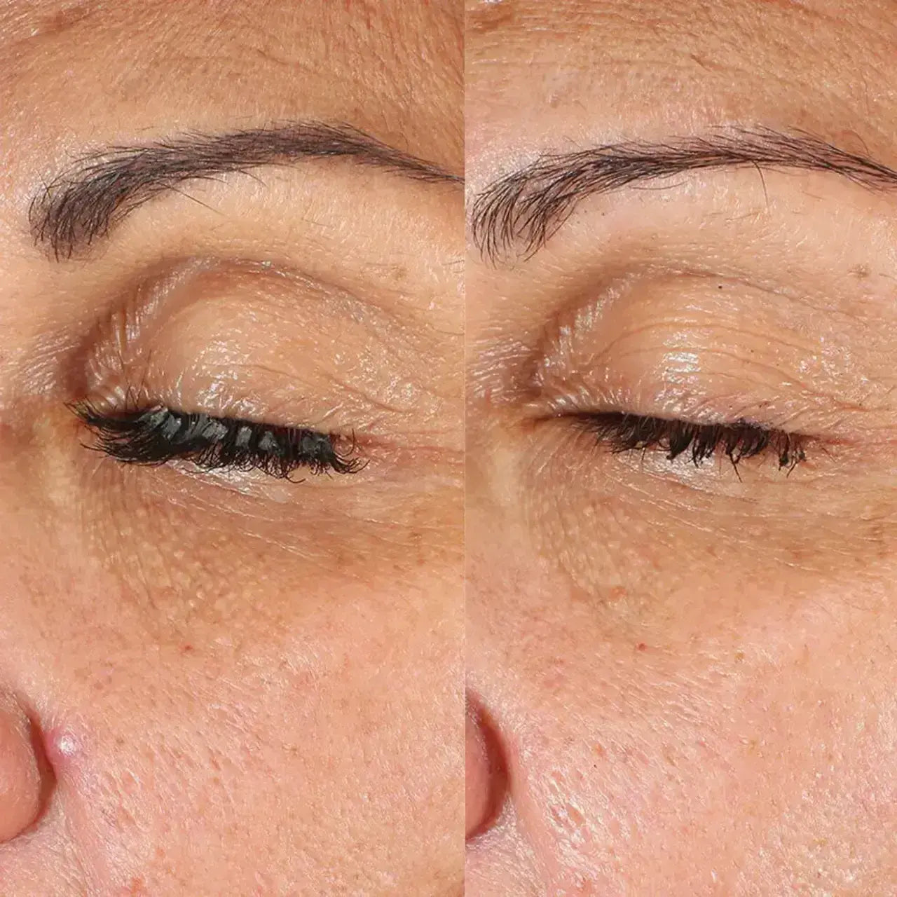 This powerful retinoid eye cream reduces dark circles and discoloration, leaving the under-eye area looking brighter and more refreshed.