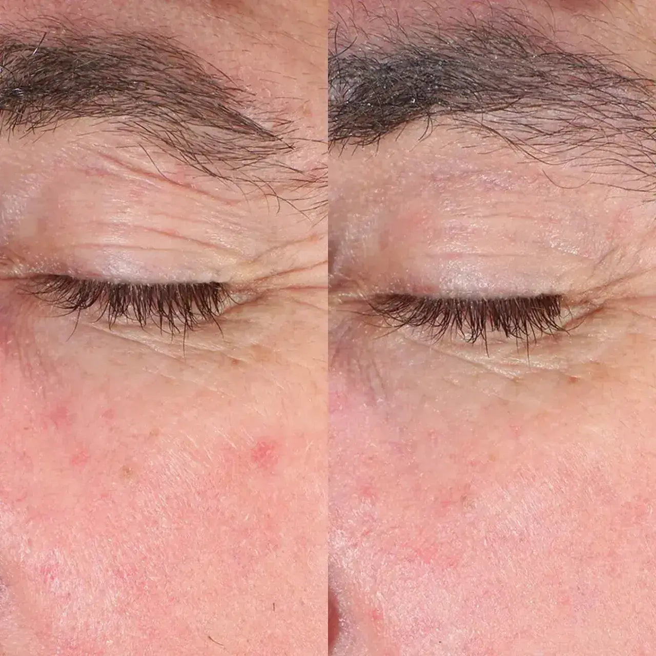 Skinbetter Science EyeMax AlphaRet® Overnight Cream provides intense hydration with hyaluronic acid and peptides, keeping under-eyes plump and nourished.