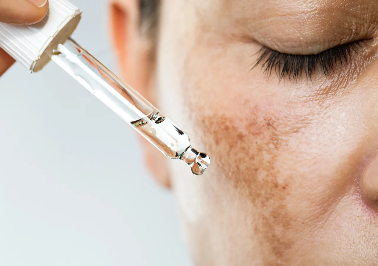 GlyMed Pigment Brightening Serum helps reduce the risk of melasma by targeting pigmentation and supporting skin clarity.