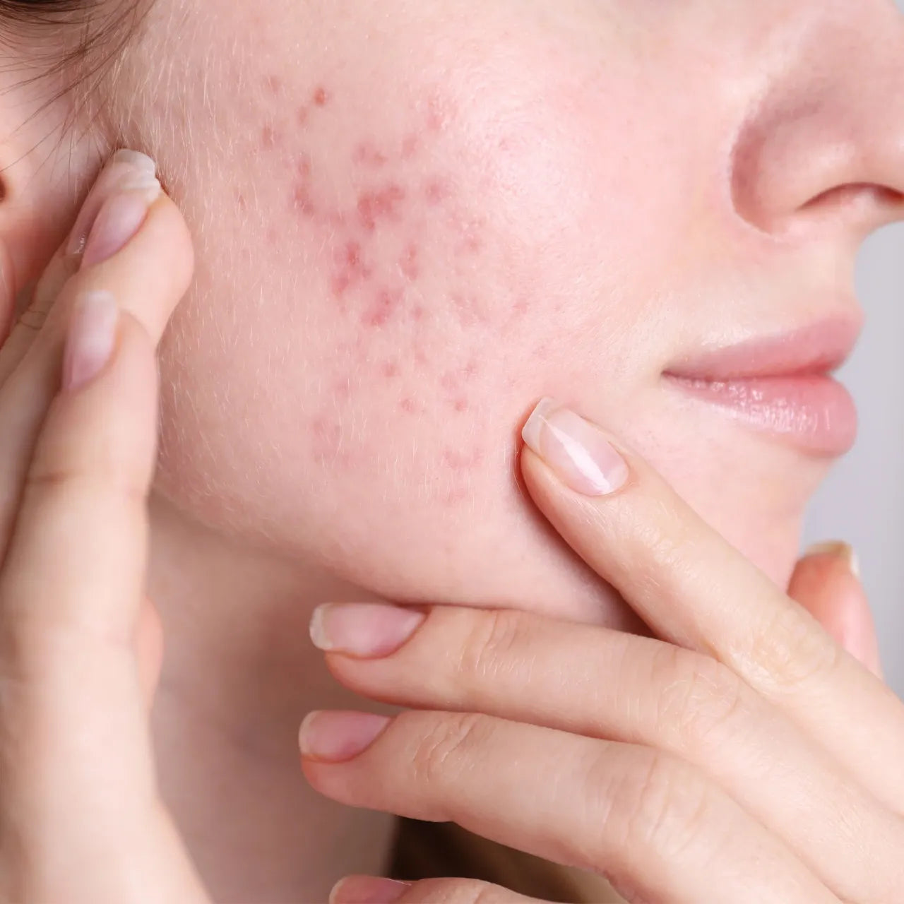 GlyMed Revitalizing Essence calms redness, soothes sensitivity, and reduces irritation with echinacea and chamomile