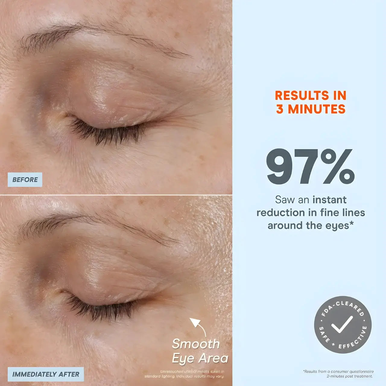 NuFACE FIX MicroWand eye, lip, and line treatment device that reduces puffiness, plumps skin, and smooths expression lines in minutes.