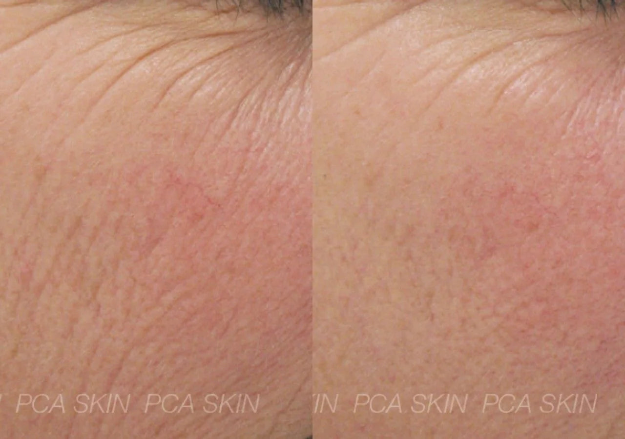 PCA Skin C-Quench Serum – Brightens and Evens Skin Tone with Vitamin C and Lilac Stem Cells