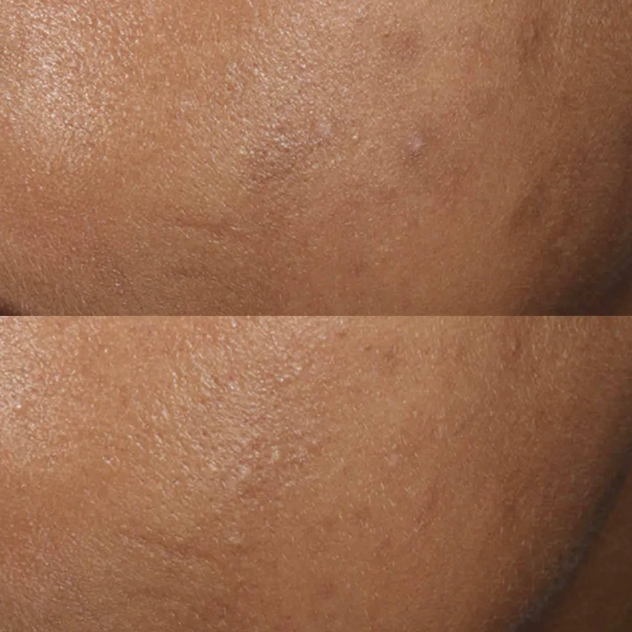 SkinCeuticals Phloretin CF® serum with vitamin C, phloretin, and ferulic acid for powerful antioxidant protection against environmental damage.