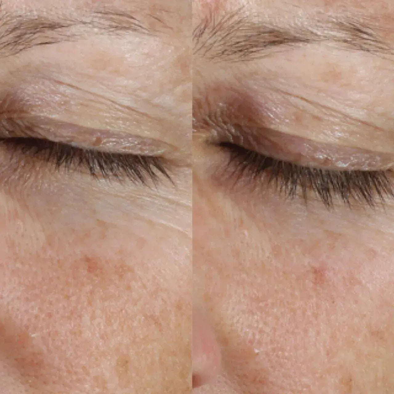 Skinbetter Science Instant Effect Gel EYE with a cooling rollerball to refresh and awaken tired eyes, reducing puffiness and fatigue.