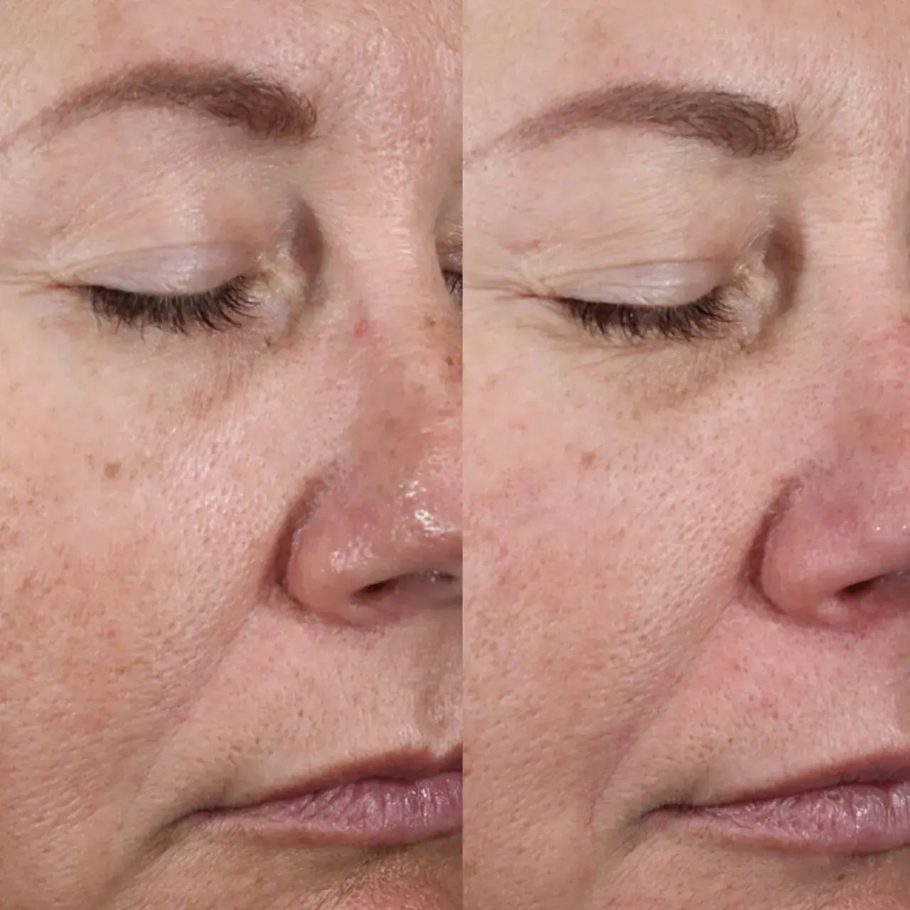 A powerful anti-aging serum that supports collagen production, smooths fine lines, and enhances skin firmness for a youthful, lifted look.