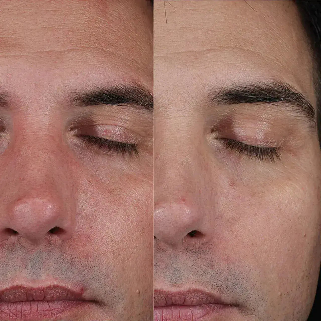 Skinbetter Science® Skin Quality Duo enhances cell turnover, reduces fine lines, and restores a youthful glow.
