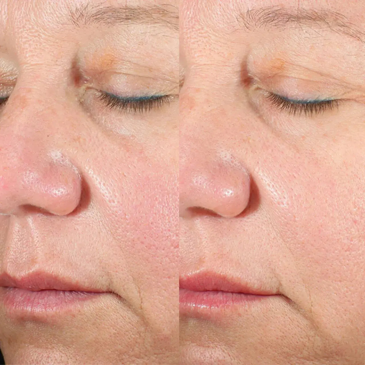 A deeply hydrating serum with ceramides and hyaluronic acid to repair the skin barrier, lock in moisture, and restore a soft, supple texture.
