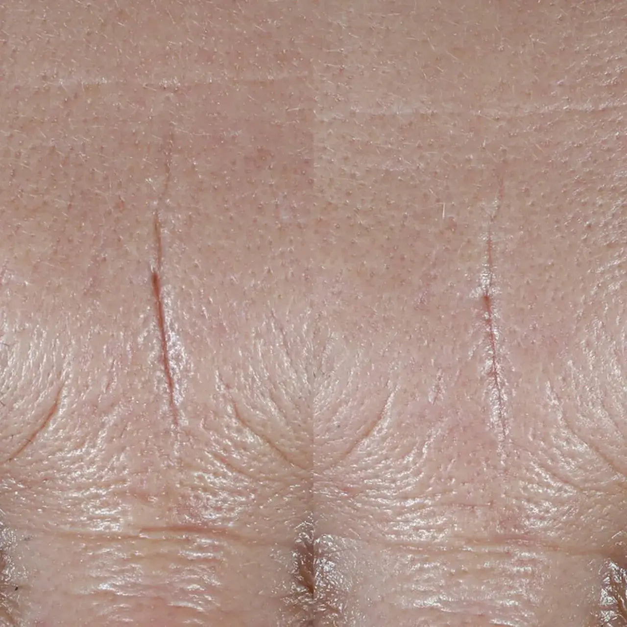 Skinbetter Science® InterFuse® Treatment Cream helps firm sagging skin, reduce fine lines, and improve elasticity with advanced peptides.