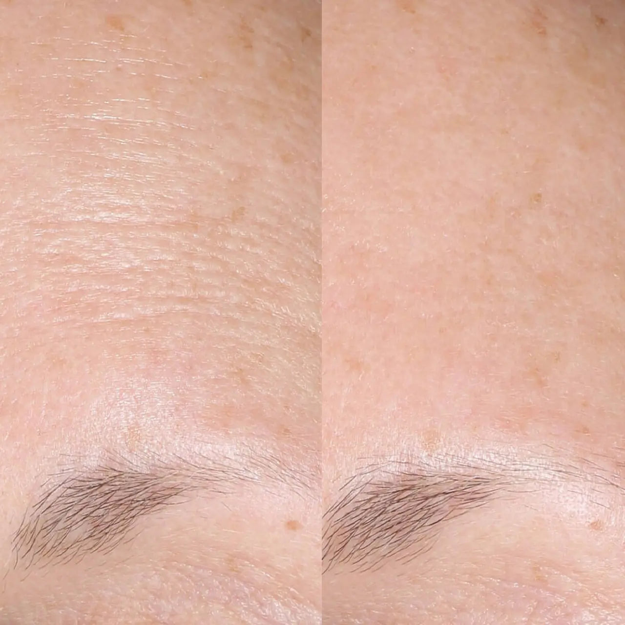 Skinbetter Science The Sunspot Power Duo deeply hydrates and nourishes skin, restoring moisture for a plump, healthy glow.