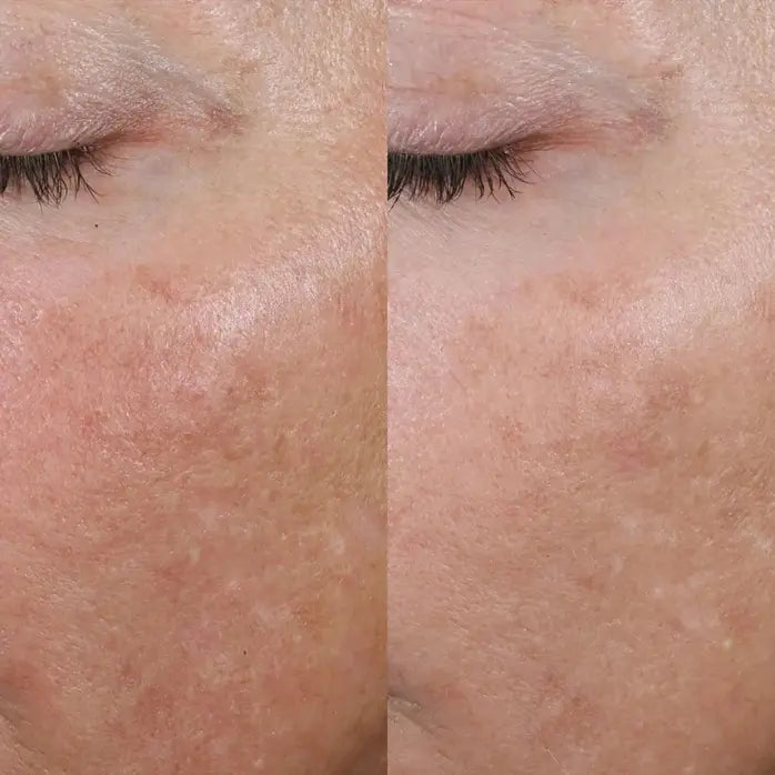 Hydrating and soothing exfoliating mask with coconut water and allantoin to calm and moisturize skin.