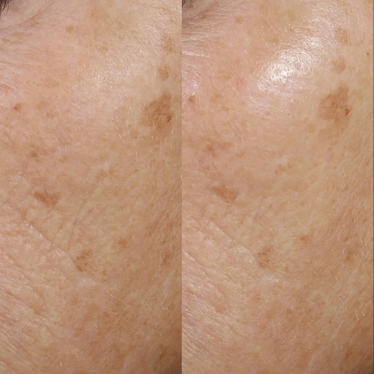 Skinbetter Science Trio Rebalancing Moisture Treatment providing deep hydration with ceramides and NMF for soft, nourished skin.