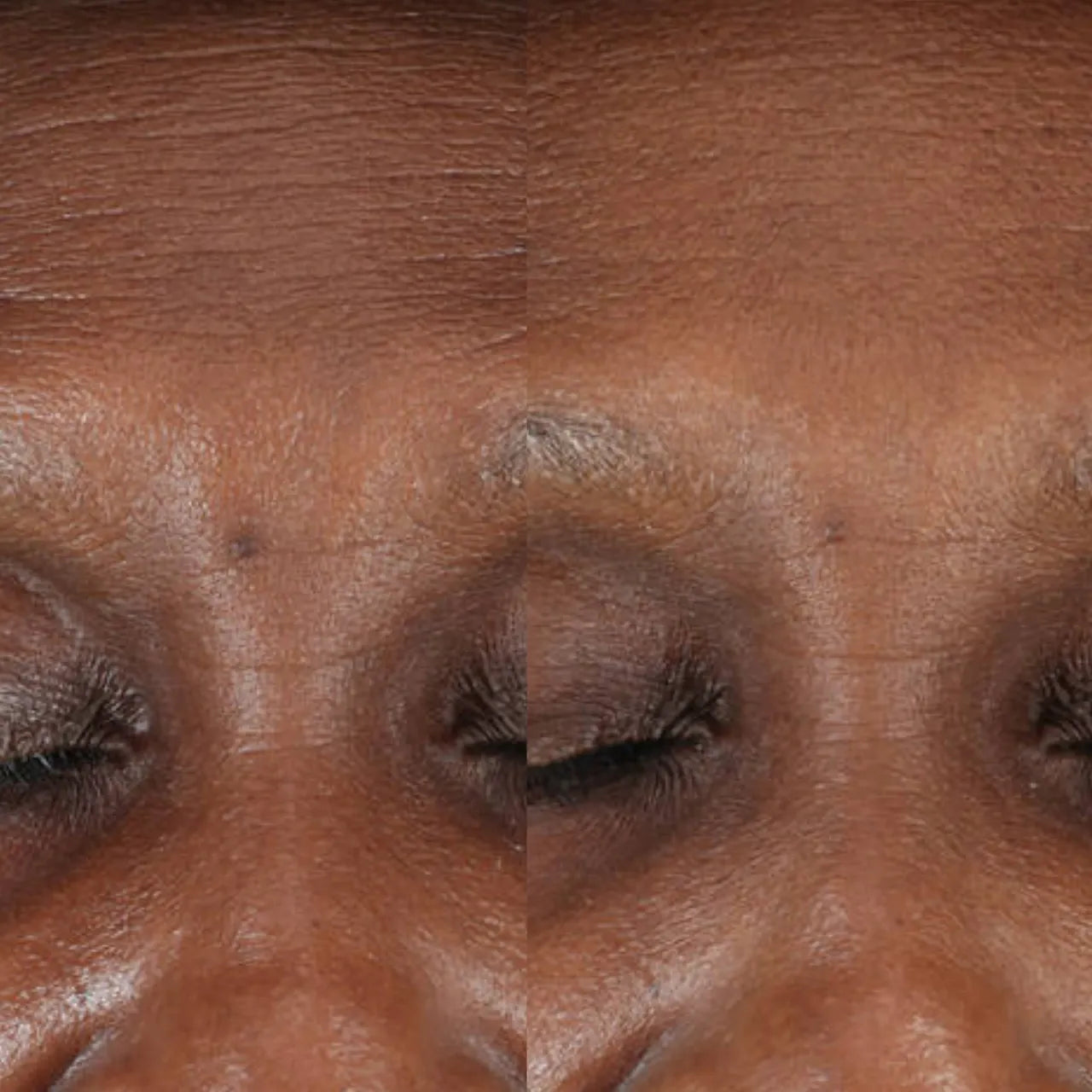 SkinCeuticals A.G.E. Interrupter Advanced helps visibly reduce wrinkles for a smoother, more youthful appearance.