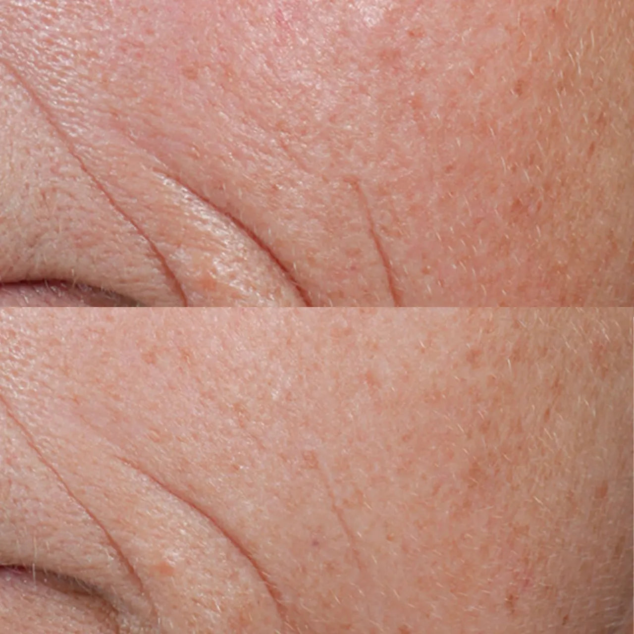 C E Ferulic helps reduce fine lines, wrinkles, and loss of firmness by boosting collagen production for a smoother, youthful complexion.