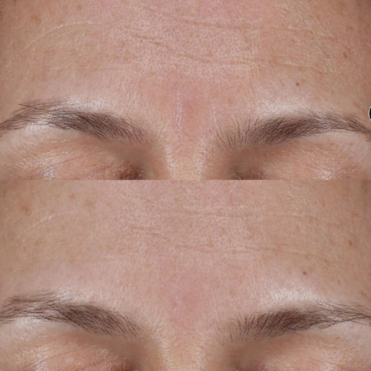 SkinCeuticals Cell Cycle Catalyst reduces visible pores with BHAs, clearing congestion and refining skin texture for a smooth, flawless look.