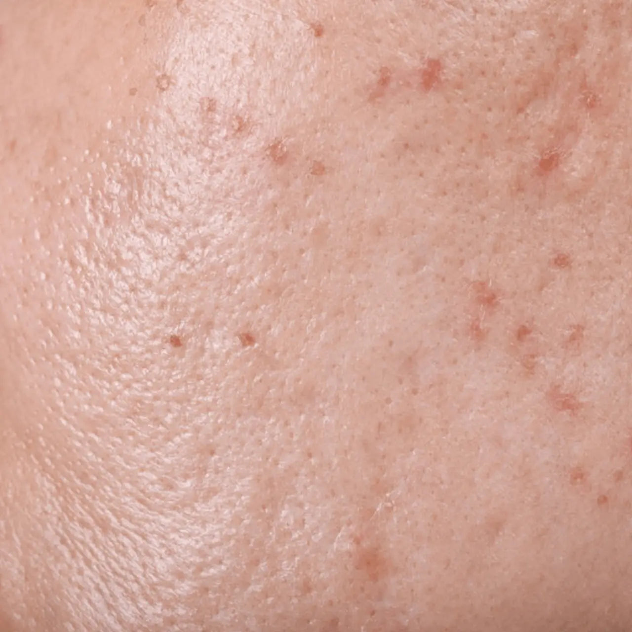 SkinCeuticals LHA Serum helps clear and unclog pores with a blend of LHA, salicylic acid, and glycolic acid for a smoother, blemish-free complexion.