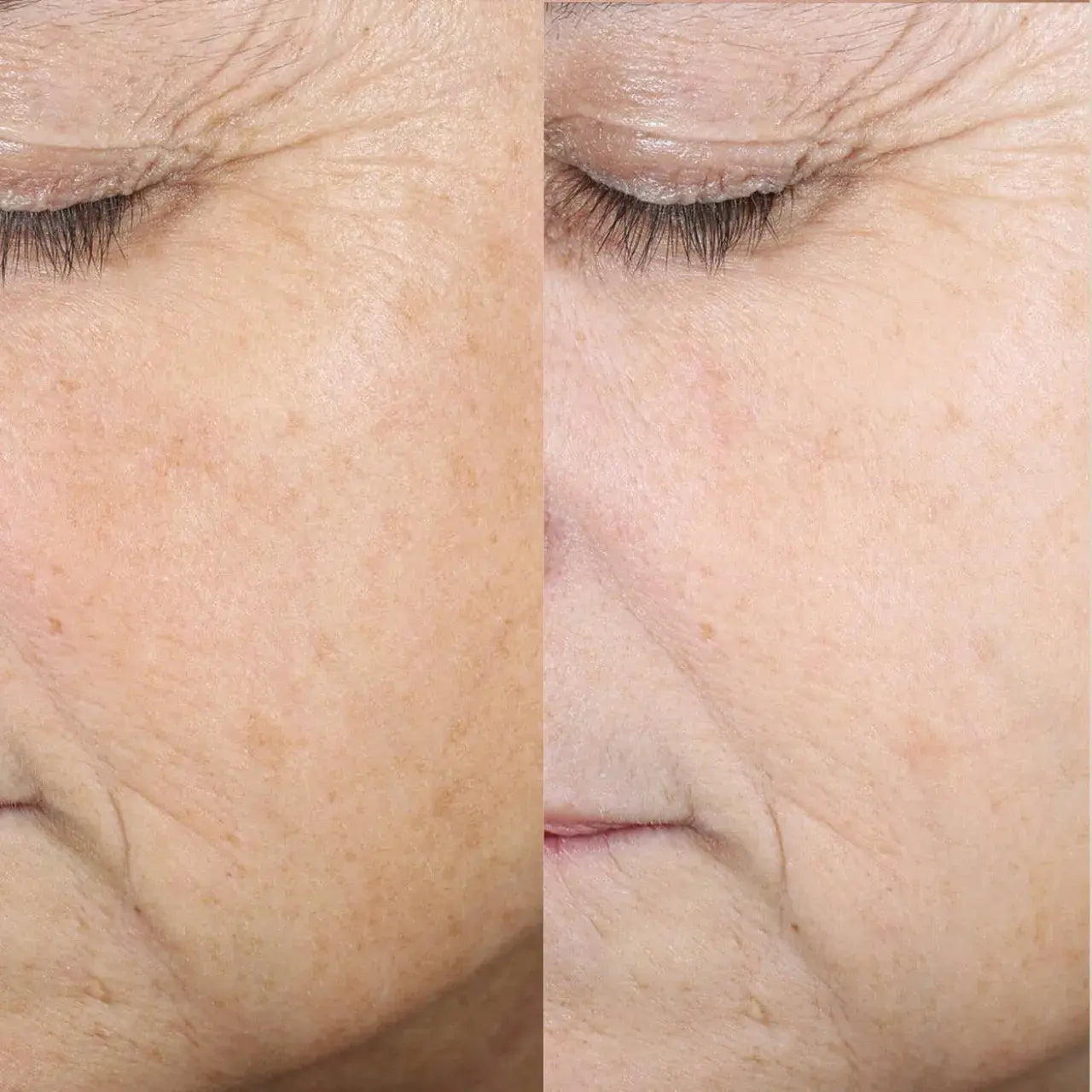 Skinbetter Science Even Tone Correcting Serum refines skin texture, smoothing roughness for a softer, healthier-looking complexion.