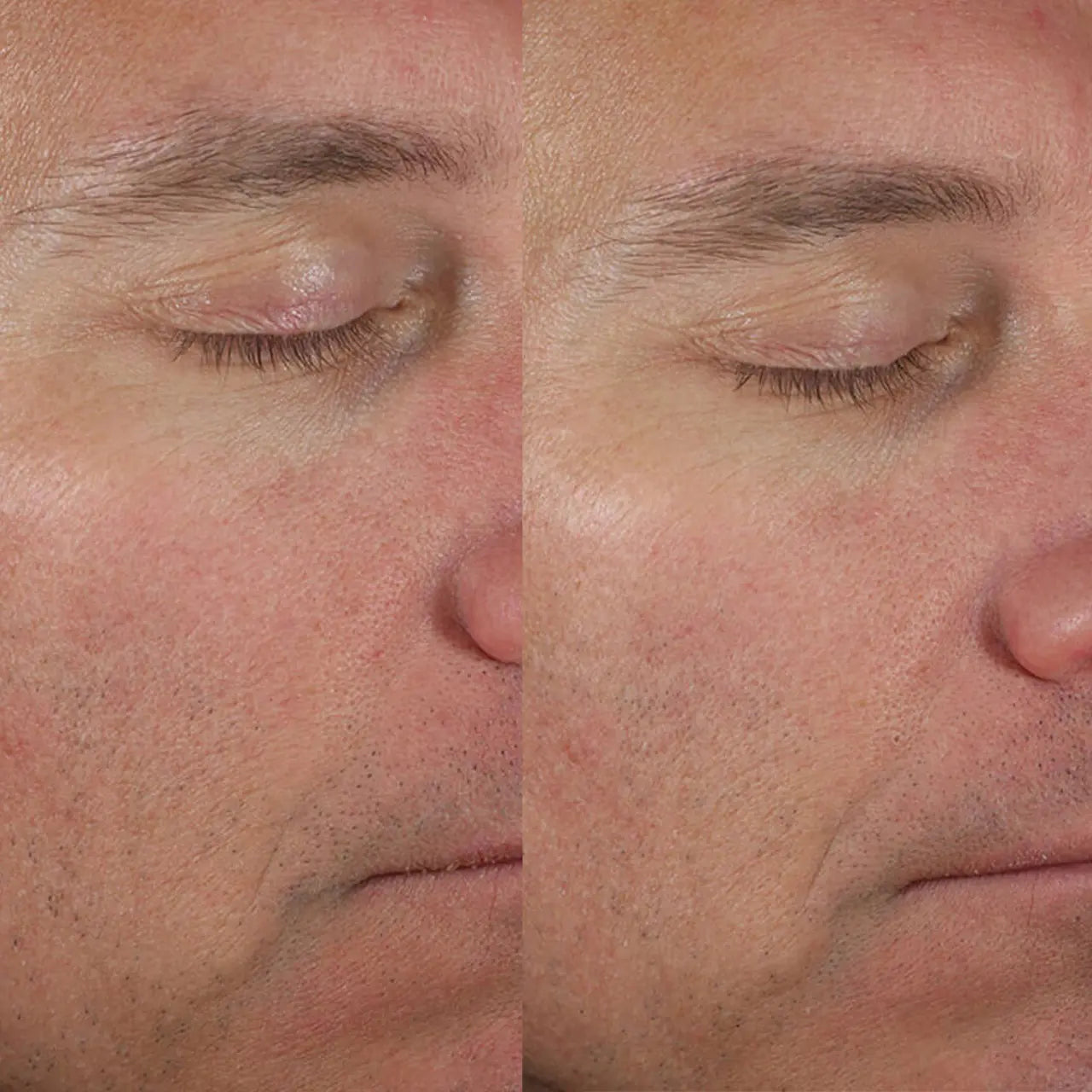 Defend against environmental damage with Solo™ Hydrating Defense MEN—packed with antioxidants to refine skin texture and enhance resilience.