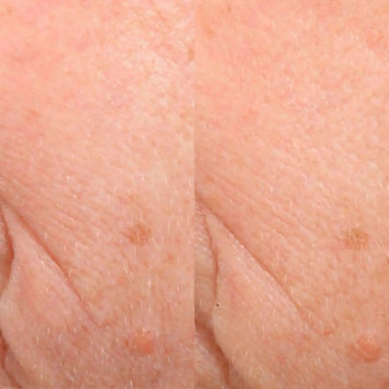 SkinCeuticals Triple Lipid Restore 2:4:2 improves firmness, reduces fine lines, and restores elasticity with a patented lipid ratio for youthful skin.