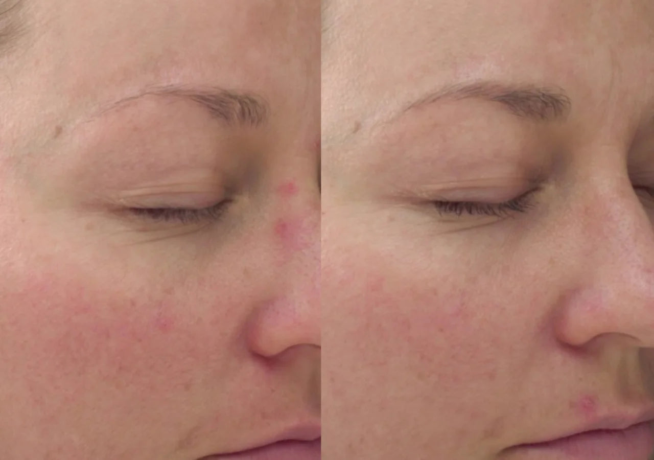Vivier Skin Brightening Cream reduces dark spots & sun damage