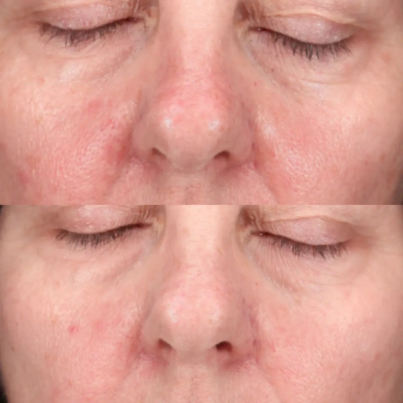 Vivier Crème 47 calms irritation, reduces redness, and strengthens sensitive skin for a balanced complexion.