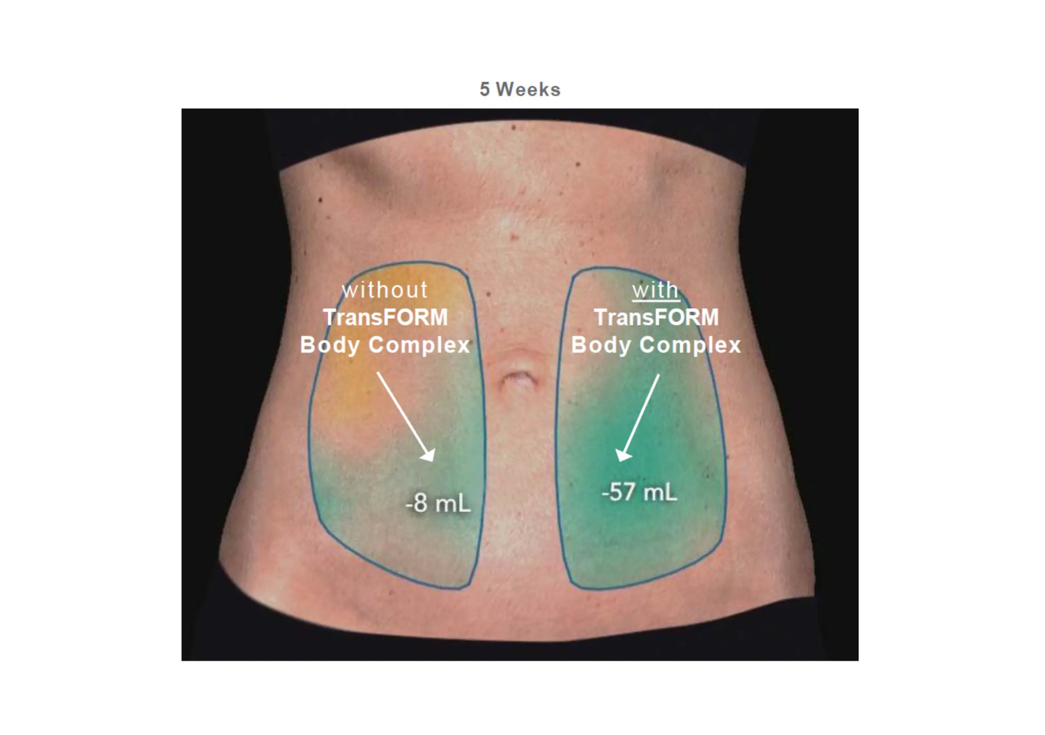 Alastin Body Treatment enhances results after body-sculpting procedures