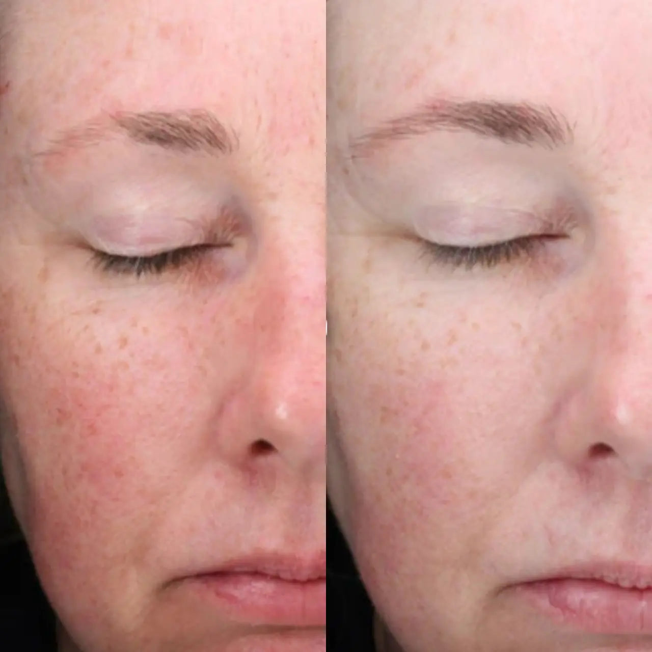 Alastin C-RADICAL Defense helps firm skin, reduce fine lines, and support collagen for youthful anti-aging benefits.