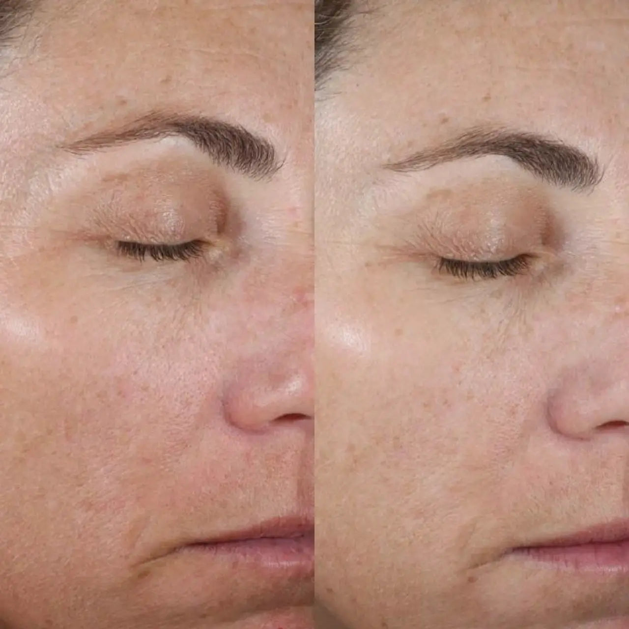 Hydrating serum with Vitamin C and Vitamin E to brighten, protect from free radicals, and restore skin’s natural glow.