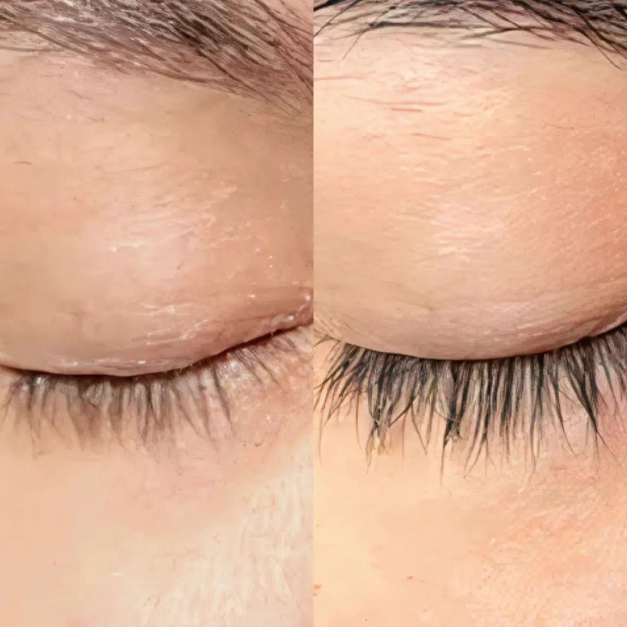 anteage brow and lash serum improving fullness and density for thicker looking hair.