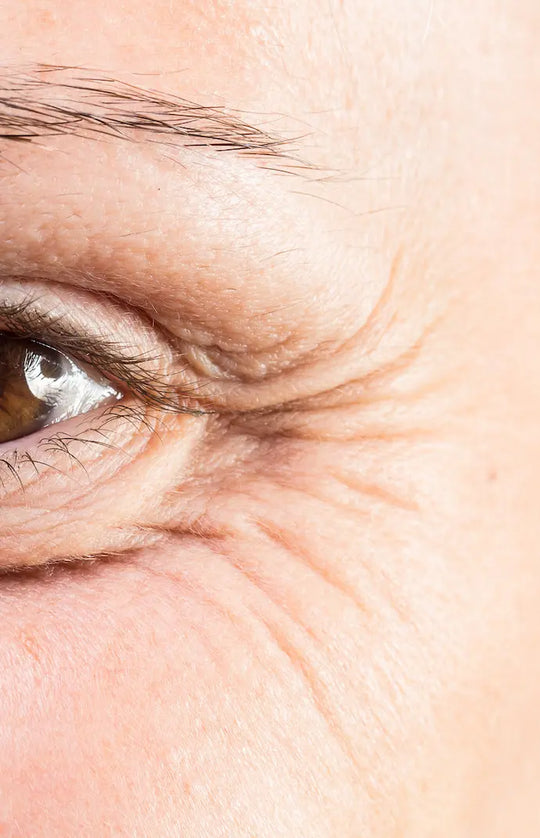 anti aging eye wrinkles