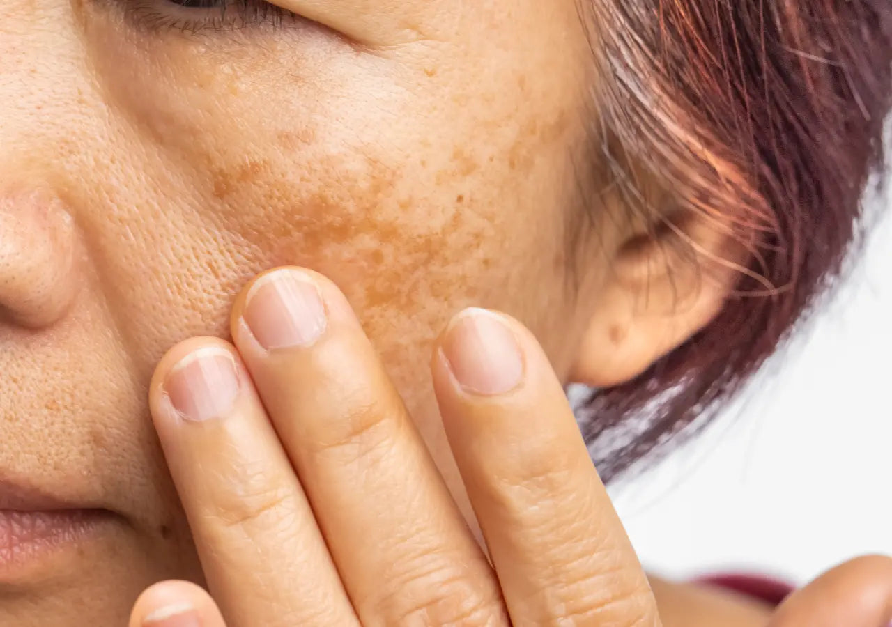 Skin brightening and tone-evening benefits of citric acid lotion.