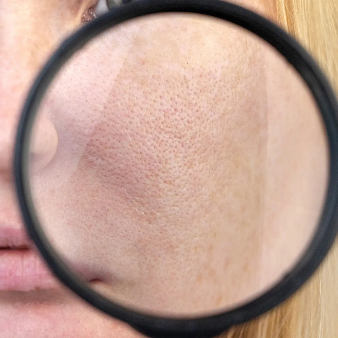 Biophora Hydra Blu Moisture Crème strengthens the skin barrier, calms redness, and balances sensitive or acne-prone skin.