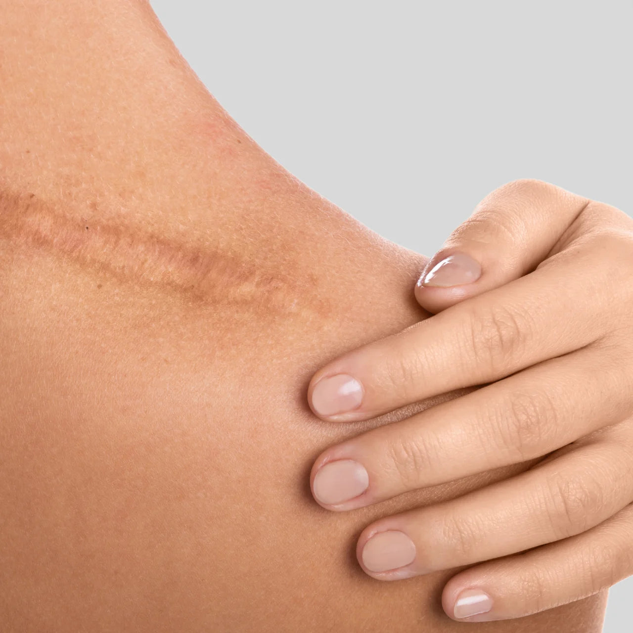 Green Envee Vahati Herb Infused Healing Oil for scar recovery and skin healing support.