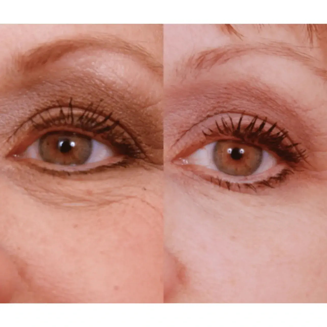 iS CLINICAL Eye Complex visibly brightens dark under-eye circles for a refreshed, radiant look.