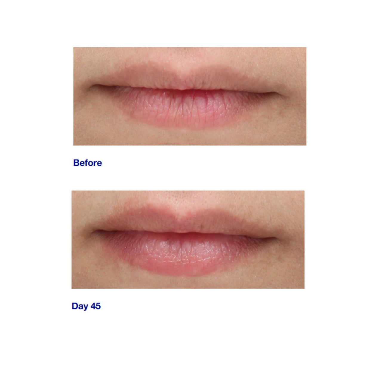 iS CLINICAL Youth Lip Elixir provides deep hydration and repair, leaving lips soft, nourished, and rejuvenated.