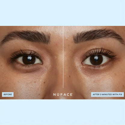 NuFACE IonPlex Hydra-Gel Power Patches Results