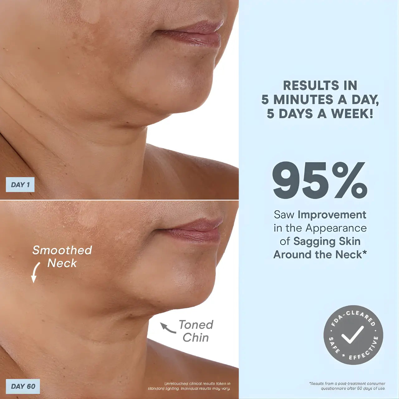 NuFACE MINI+ Starter Kit Smart Petite Microcurrent Facial Toning Device Results