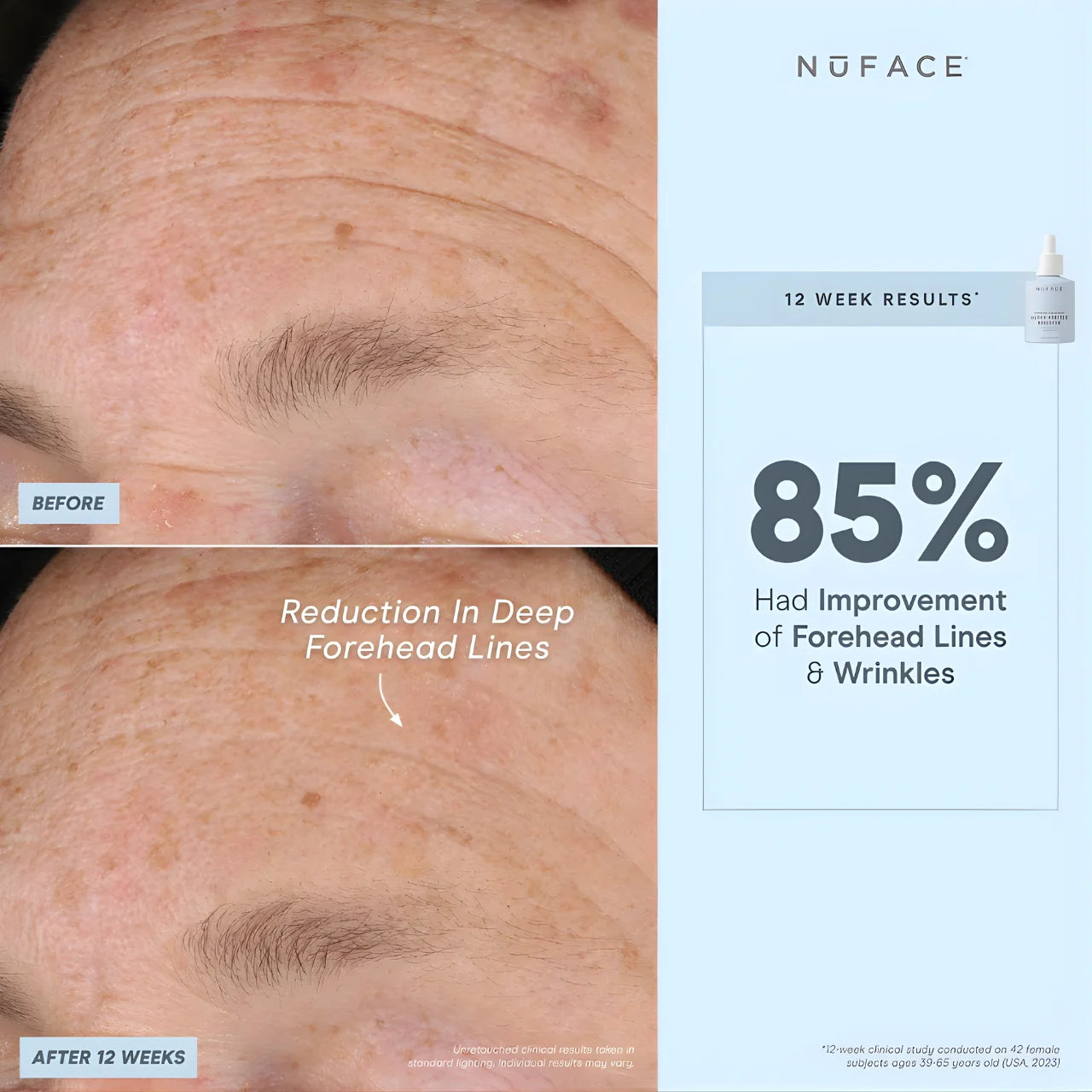 NuFACE Super Peptide Booster Serum for anti-aging, firming, and wrinkle reduction 12 Week Results
