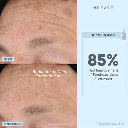 NuFACE Super Peptide Booster Serum for anti-aging, firming, and wrinkle reduction 12 Week Results