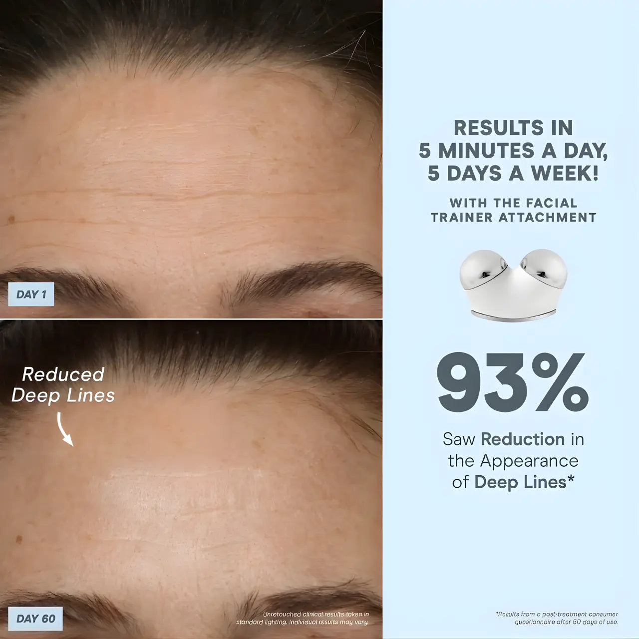 NuFACE TRINITY+ Complete Set Smart Microcurrent and LED Red Light Facial Toning Kit Results