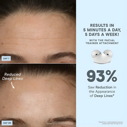 NuFACE TRINITY+ Complete Set Smart Microcurrent and LED Red Light Facial Toning Kit Results