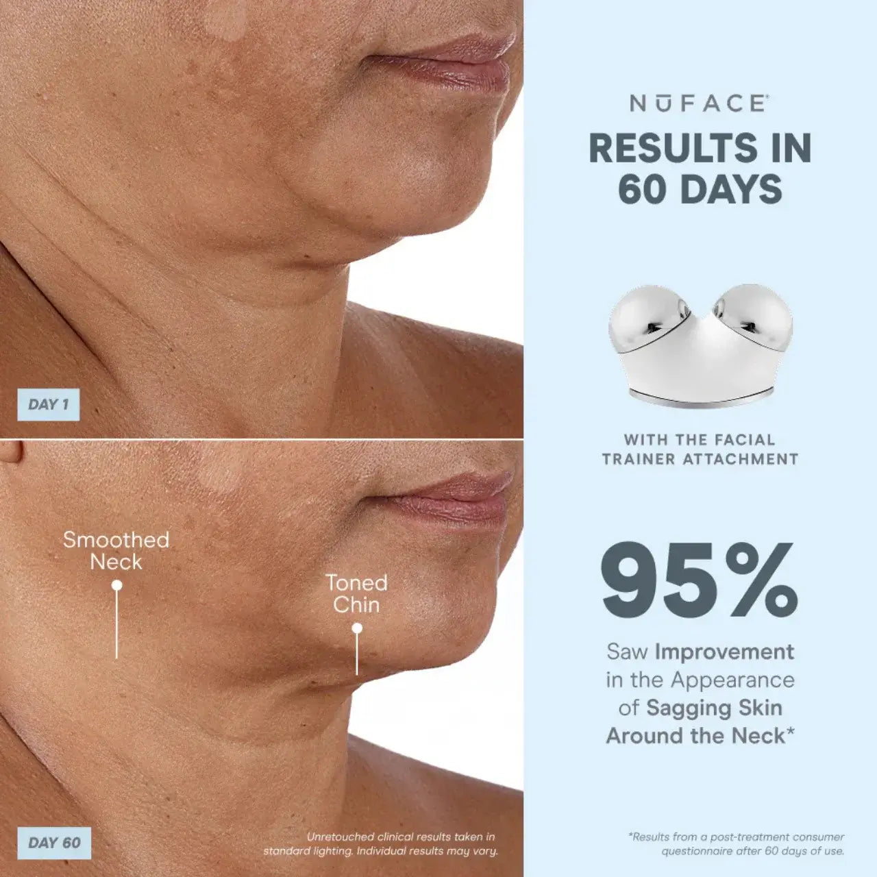 NuFACE Trinity+ PRO Firming and Sculpting Device helps lift facial contours, reduce sagging, and smooth fine lines for firmer, radiant skin.
