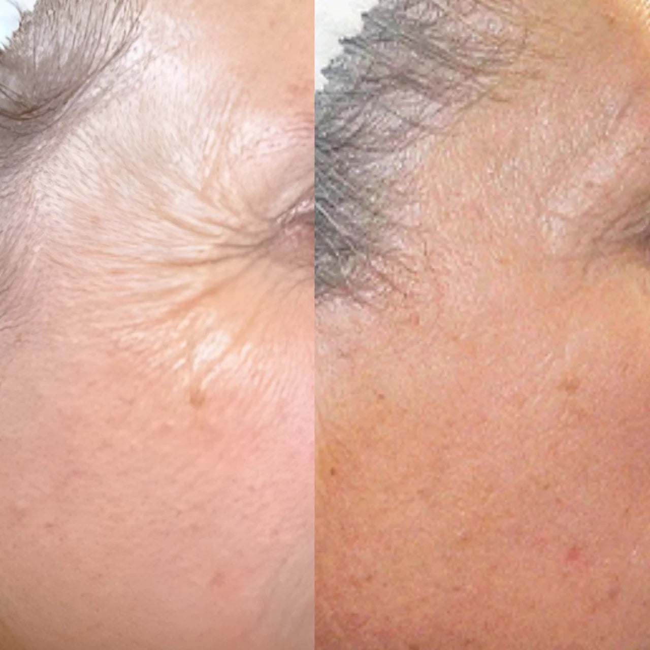 Osmosis Catalyst MD Advanced serum firming boost – tightens and lifts skin for improved elasticity and youthful contour.