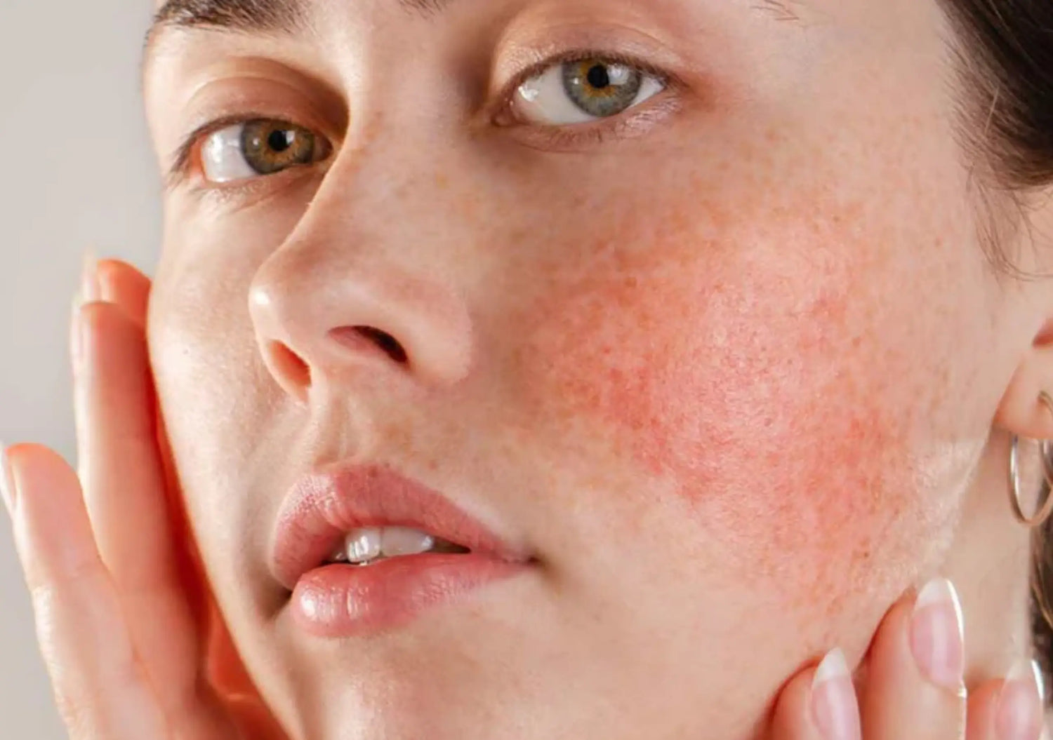 Serum calming and reducing redness with Trioxolane