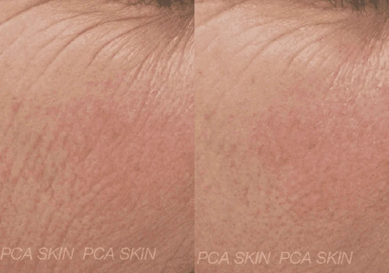 PCA Skin C-Quench Serum – Brightens and Evens Skin Tone with Vitamin C and Lilac Stem Cells