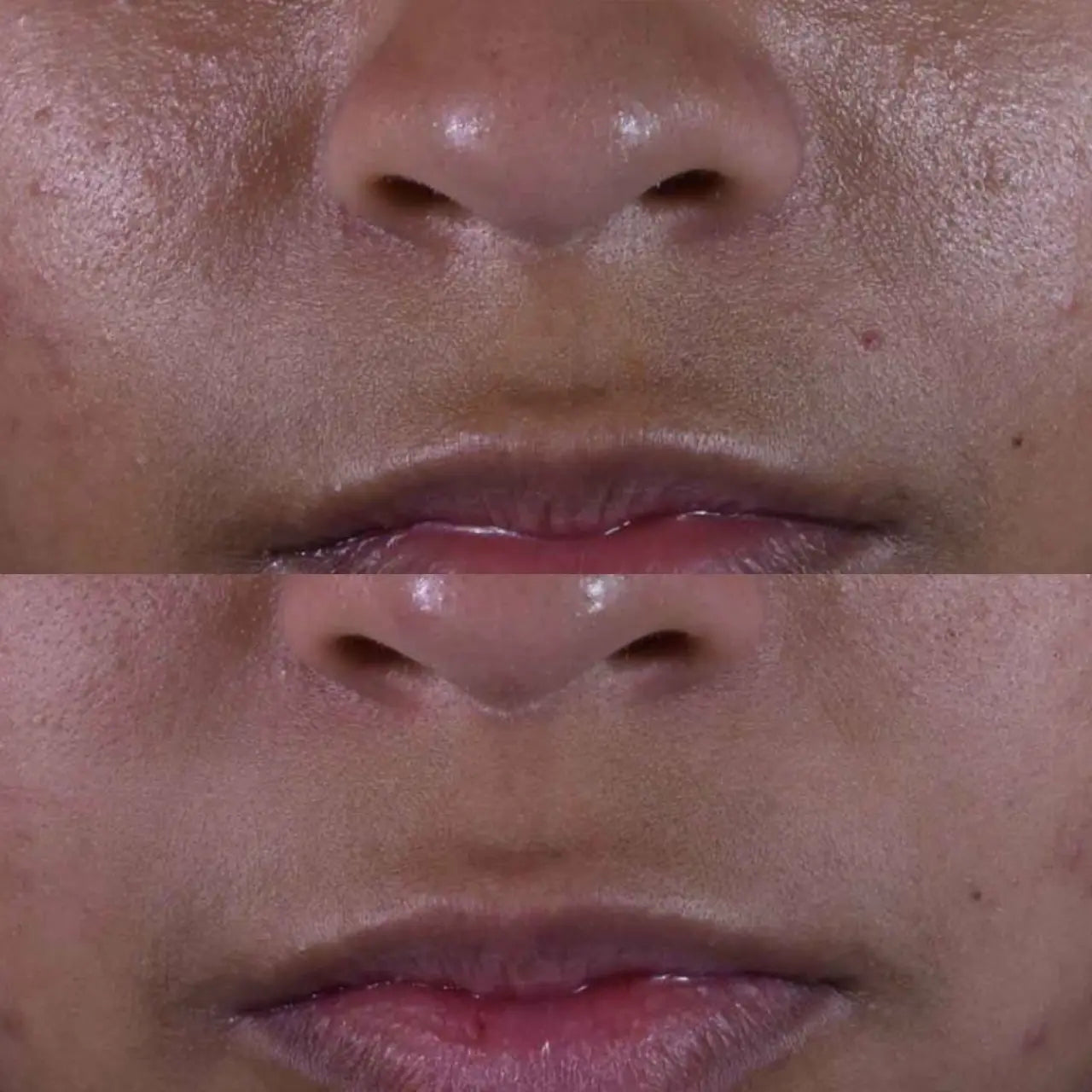 SkinCeuticals Silymarin CF helps reduce excess oil, minimize shine, and prevent clogged pores for balanced, healthy skin.